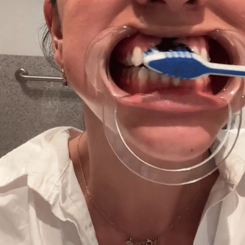 Clareador Dental Instantâneo Smilekit®