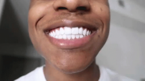 Clareador Dental Instantâneo Smilekit®